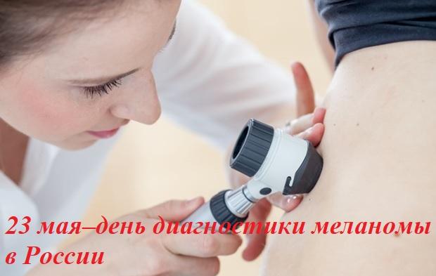 23 мая - День диагностики меланомы в России